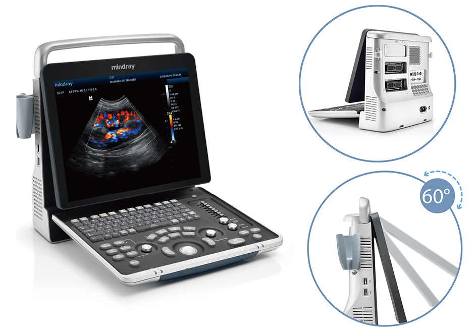 兽用便携式超声诊断仪医疗器械设计的要点与设计要求