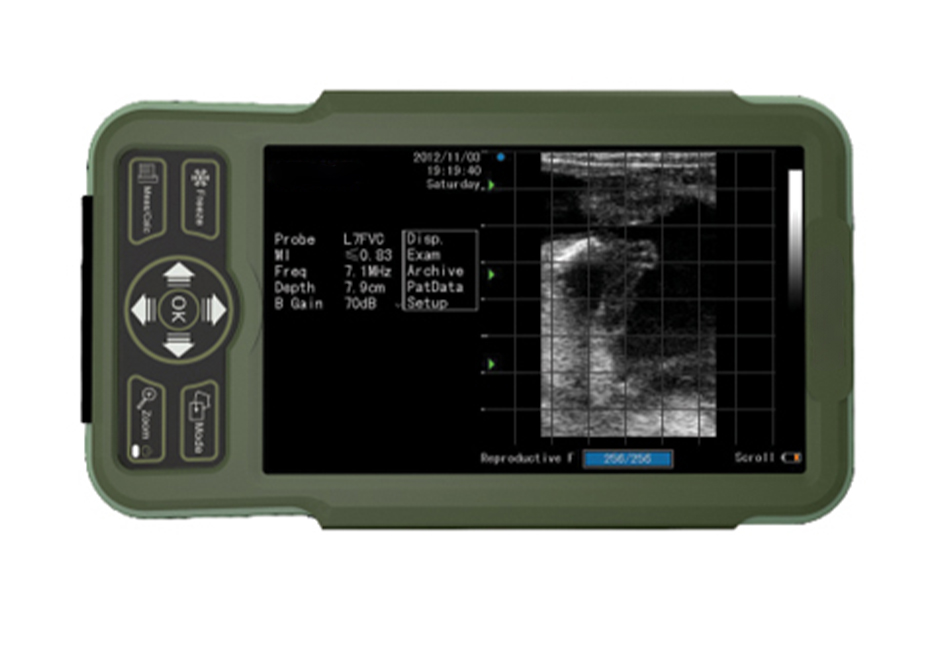 掌上兽医超声系统医疗设备设计
